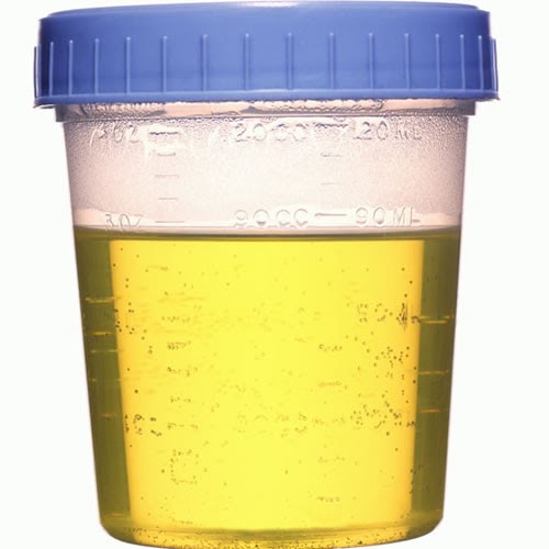 urine general test